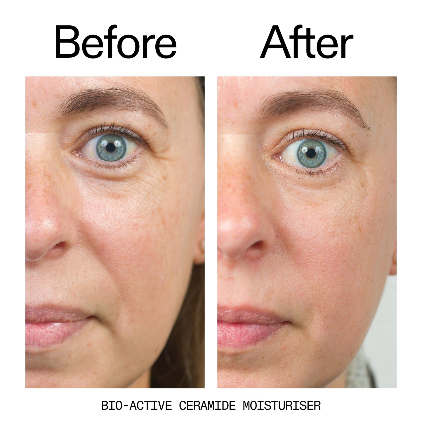 barrier-boosting-trio-p2 Bio-Active_Before_After_2000x2000_600947b4-e8c5-425a-9155-fc15bc83aa12.jpg