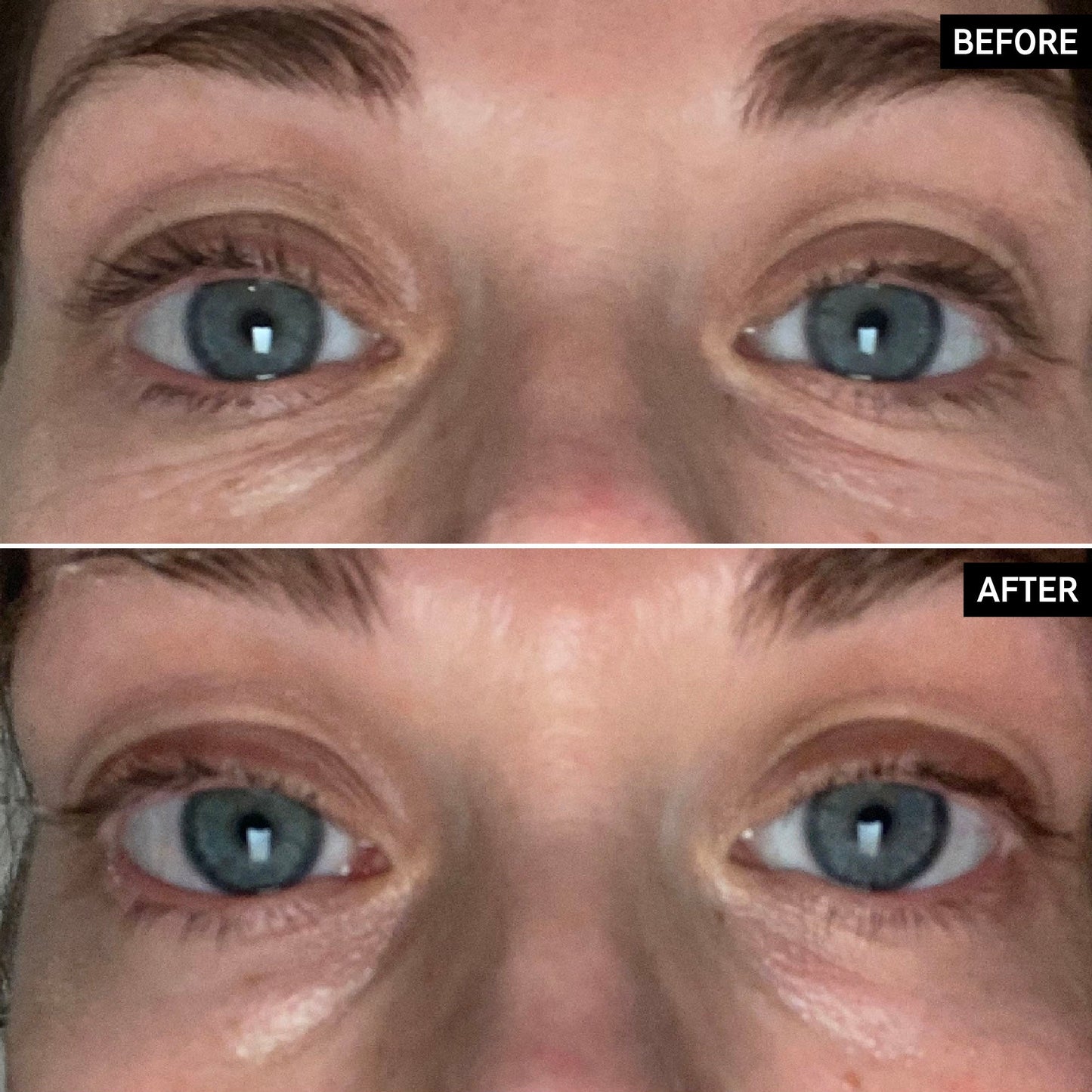 retinol-eye-cream-s7 SITE-UGCBAsApril_Nicole_B_A_PPage_2000x2000_1.jpg