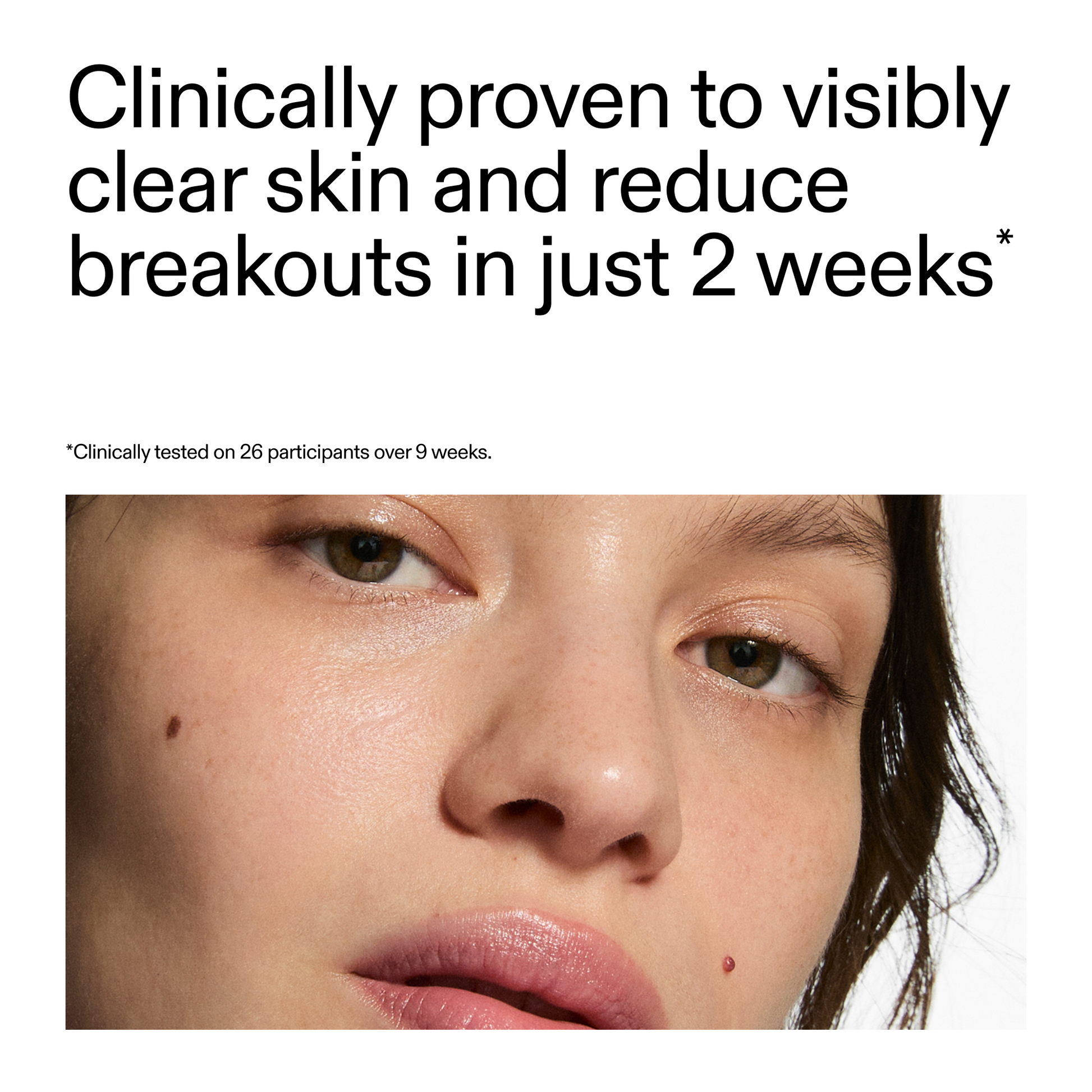 360-acne-clearing-serum-v3 360_Serum_Key_Claim.png