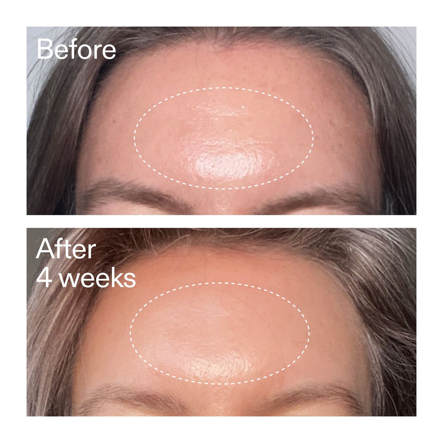 advanced-0-2-retinal-serum-duo-h1 AdvancedRetinal_BeforeAfter1_2000x2000_4e9c798a-f30e-45b8-a34a-7c4740f2f2cb.jpg