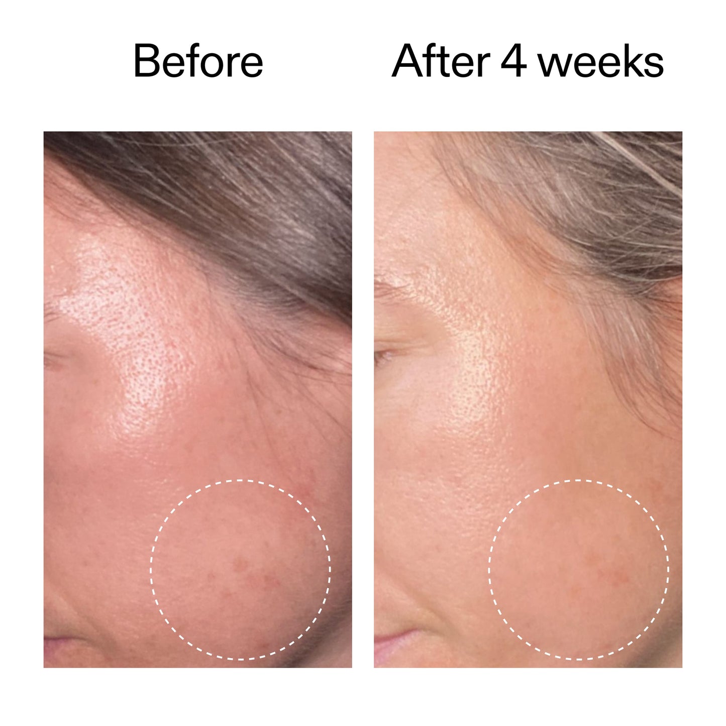 advanced-0-2-retinal-serum-duo-h1 AdvancedRetinal_BeforeAfter2__2000x2000_8ef75542-2316-4814-81ee-0f66a85912bc.jpg