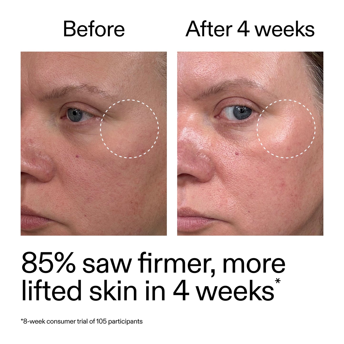 advanced-0-2-retinal-serum-w5 AdvancedRetinal_BeforeAfter_Claim1_2000x2000_bcc385c4-5e73-4f1e-aba8-64267937d0d3.jpg