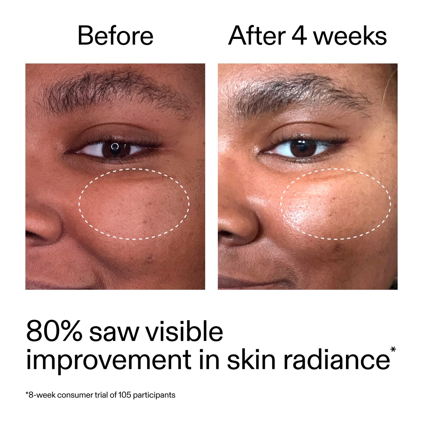 advanced-0-2-retinal-serum-duo-h1 AdvancedRetinal_BeforeAfter_Claim2_2000x2000_681b621d-8d44-4d44-9a40-89244f9b2e53.jpg