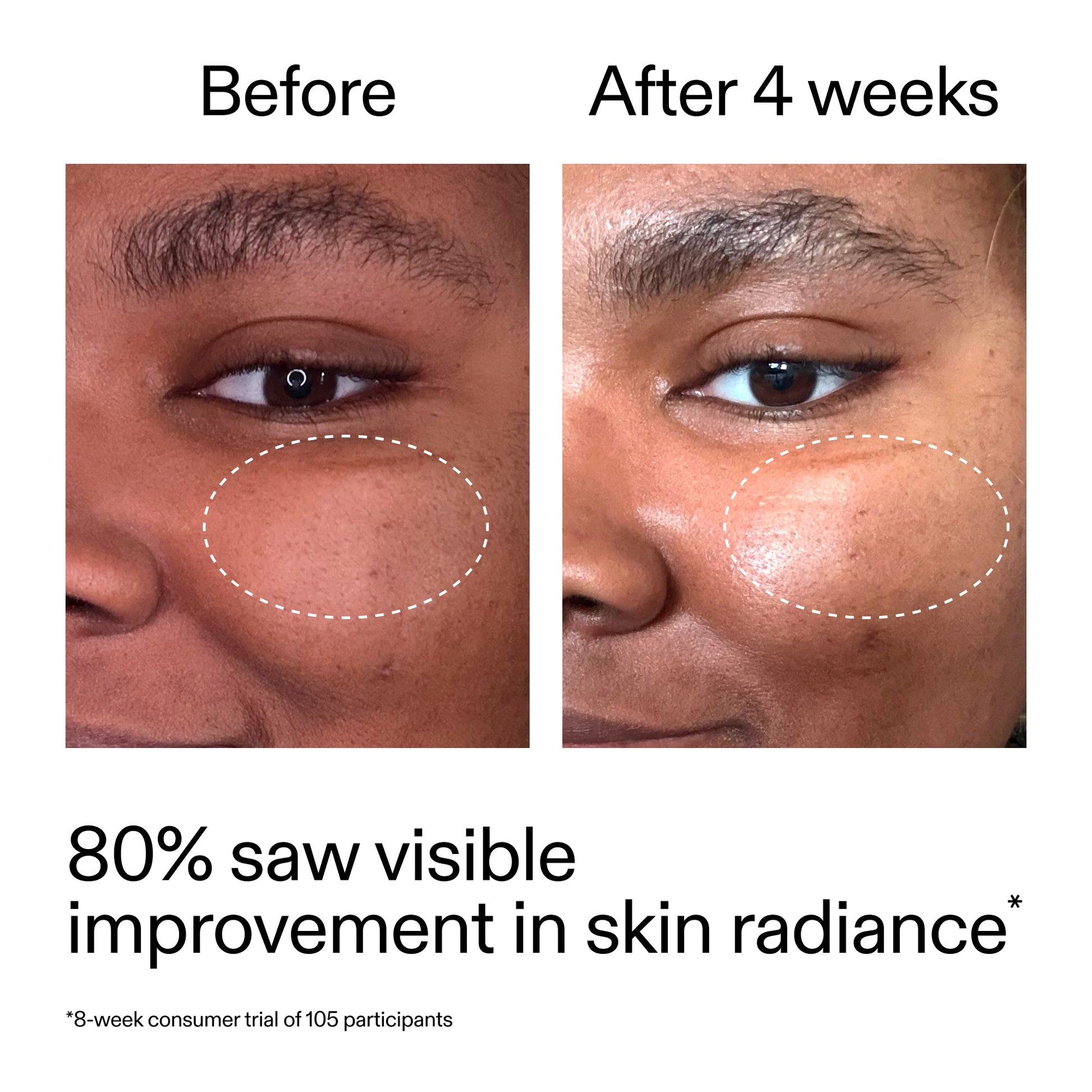 advanced-0-2-retinal-serum-duo-h1 AdvancedRetinal_BeforeAfter_Claim2_2000x2000_681b621d-8d44-4d44-9a40-89244f9b2e53.jpg
