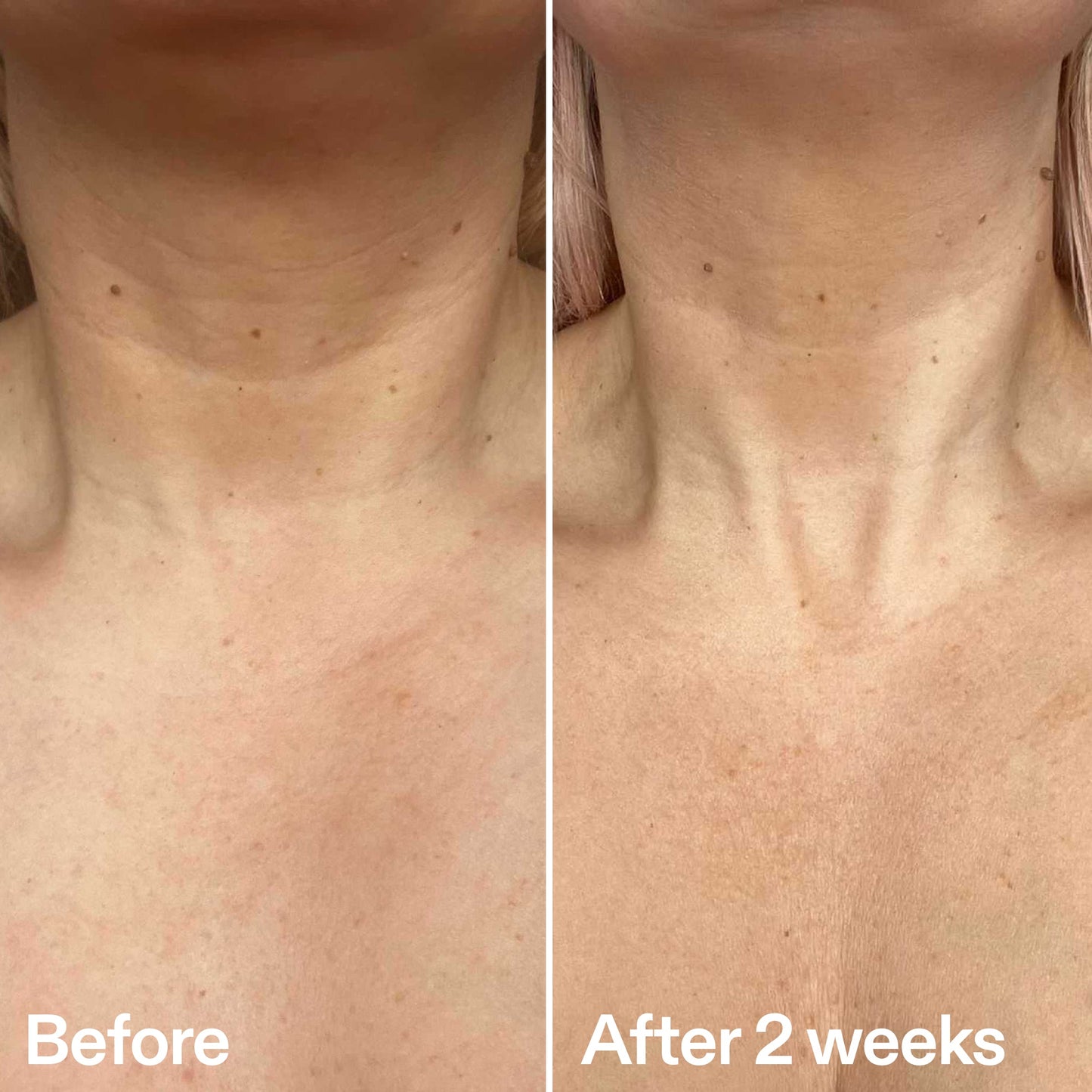 bio-active-neck-lift-stick-u8 B_A_2.jpg
