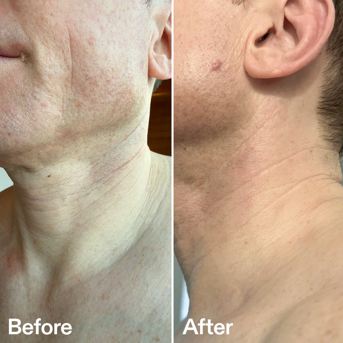 bio-active-neck-lift-stick-u8 B_A_afa2743e-b8e2-4504-92f4-e281cb6cf759.jpg