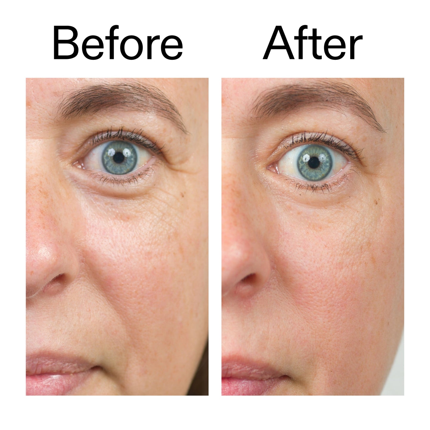 bio-active-ceramide-moisturizer-duo-s7 Bio-Active_Before_After_2000x2000_566e5a9e-135e-417a-8242-b44e5fa35463.jpg