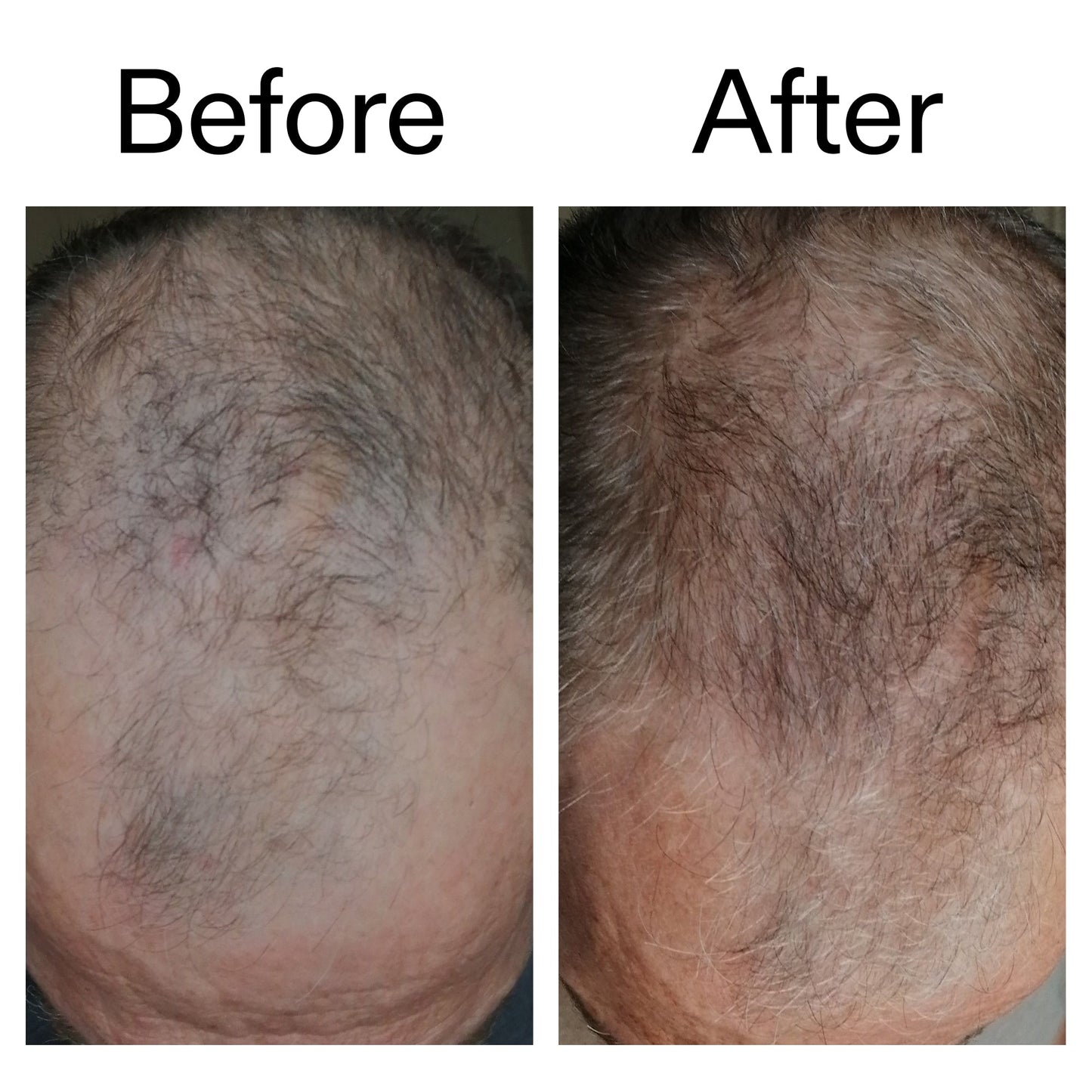 3-month-hair-growth-trio-v6 Caffeine_Scalp_Treatment_B_A_Ppage_2000_x_2000.jpg