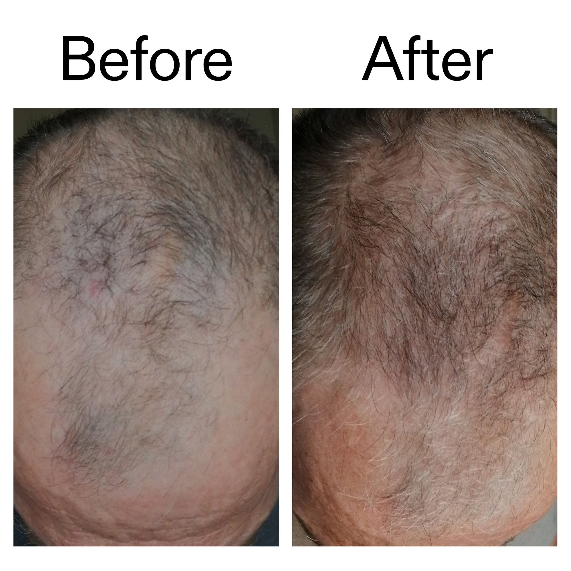 3-month-hair-growth-trio-v6 Caffeine_Scalp_Treatment_B_A_Ppage_2000_x_2000.jpg