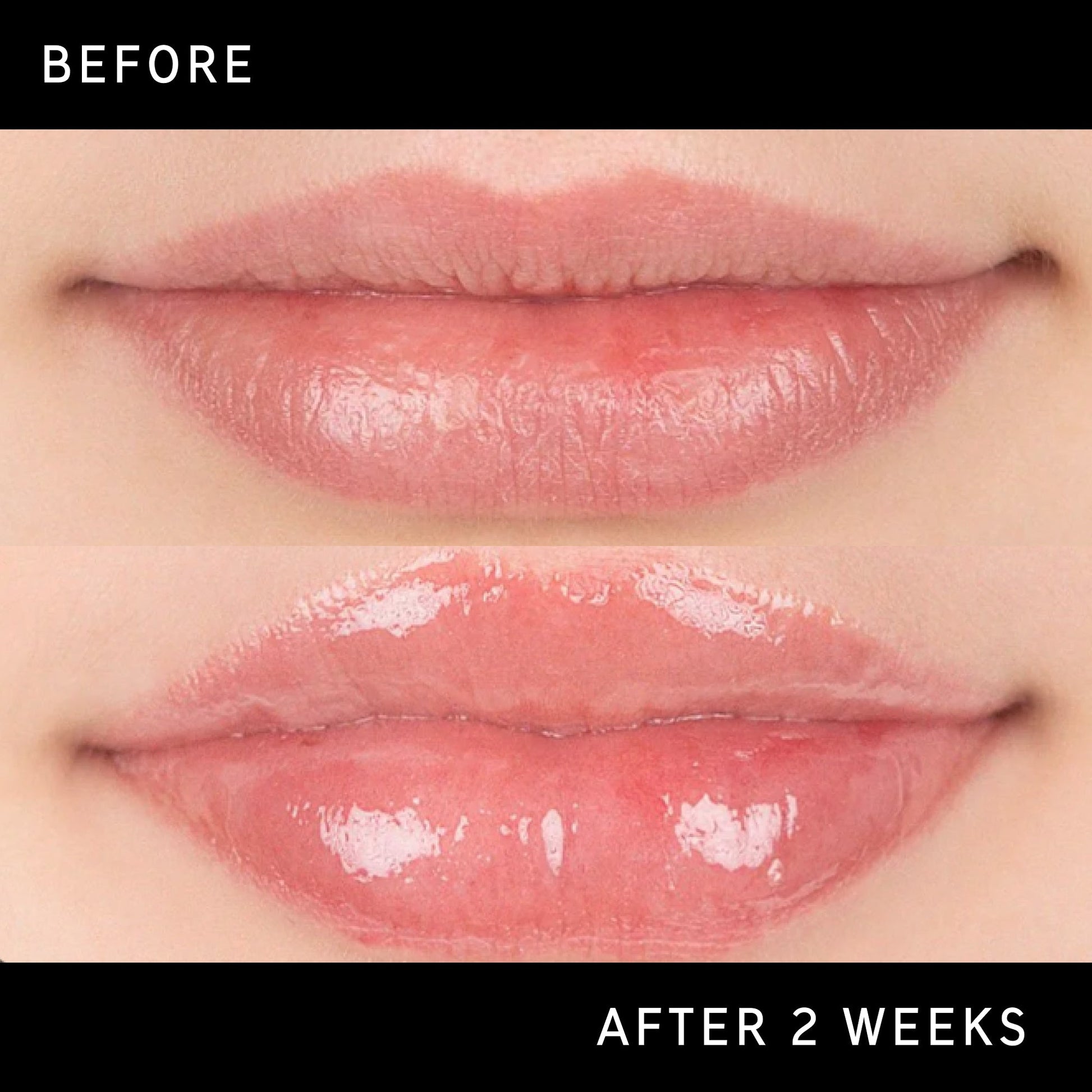 lip-plumping-duo-j4 DTC-Top15_Amends_Tripeptide-Lip_B_A.jpg