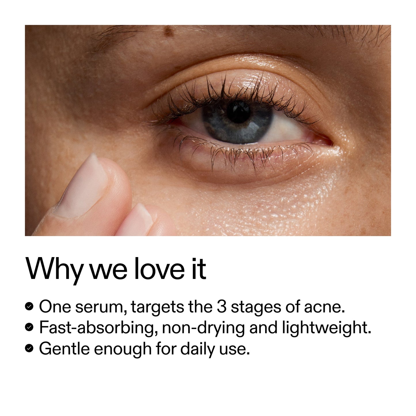 360-acne-clearing-duo-n9 Dioic_Whyweloveit_2000x2000_175aafd3-0cbe-403a-b317-a8362881bfe2.jpg
