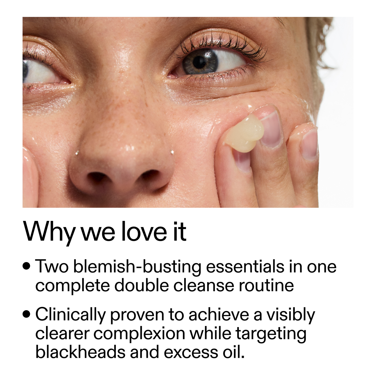 acne-double-cleanse-duo-x1 Double_Cleanse_Duo_for_Breakouts_Why_We_2000x2000_f242cb12-bb5c-487c-b203-071ccb406ec5.png