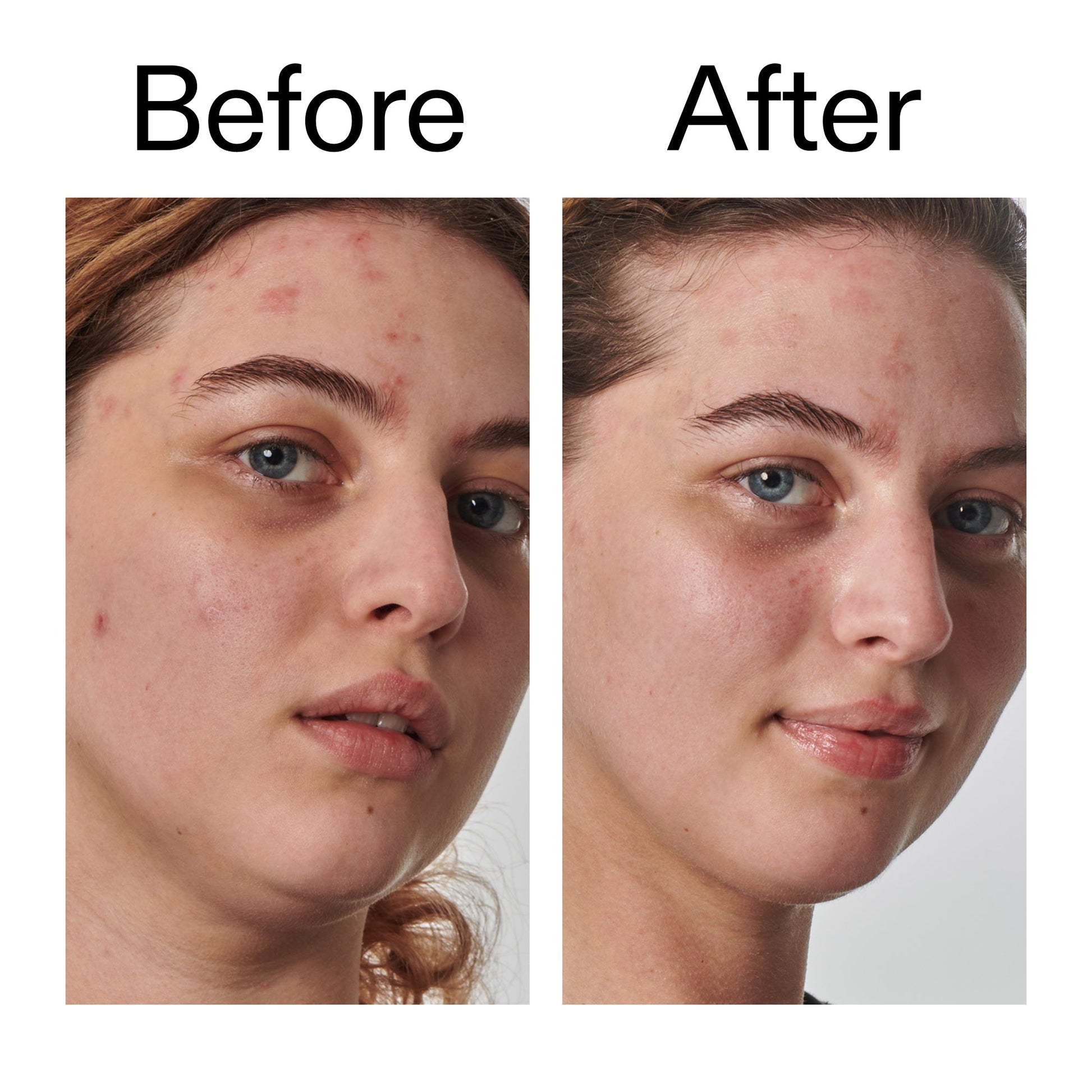 10-urea-moisturizer-w7 Dry_and_Rough_Skin_Solution_Before_After_2000x2000_efa6e639-5c39-49bd-a5dd-f0220293120a.jpg
