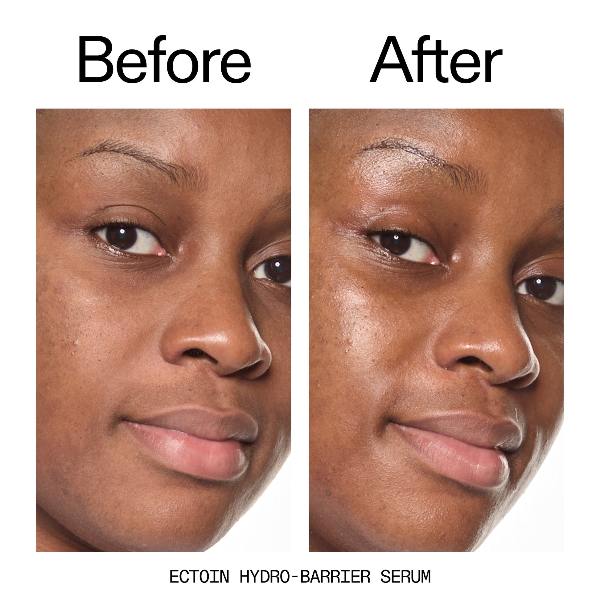 barrier-boosting-trio-p2 Ectoin_Before_After_2000x2000_ce35bc41-4da0-4b6f-adc7-29f8641f6c6c.jpg
