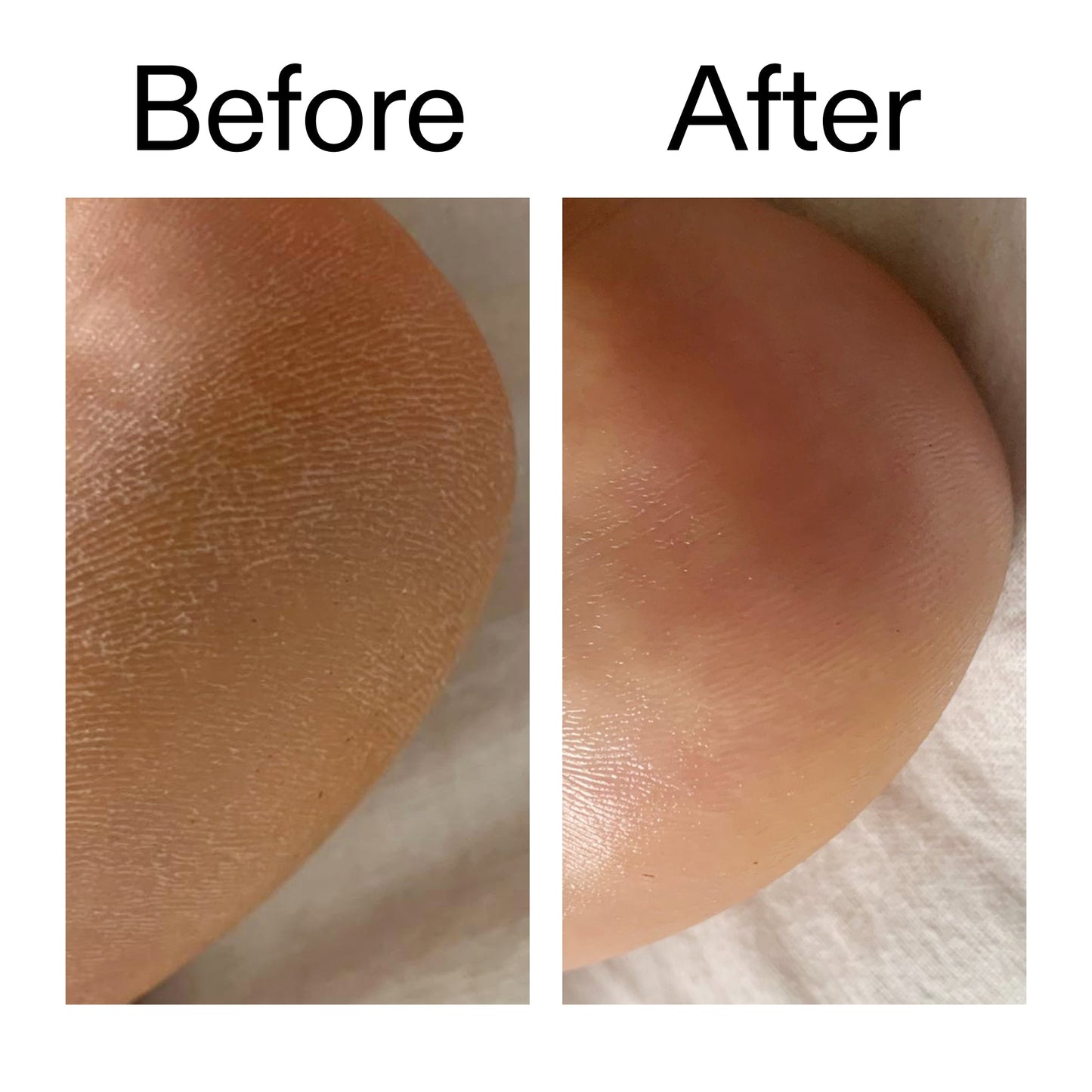 glycolic-acid-exfoliating-body-stick-duo-k6 Glycolic_Acid_Exfoliating_Body_Stick_Before_After_V1_2000x2000_a3043625-9400-429a-a7fb-d6dbd220f722.jpg