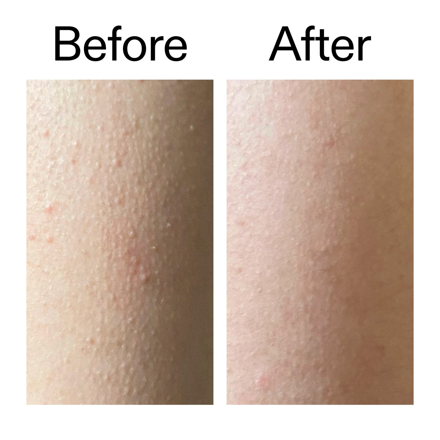 glycolic-acid-exfoliating-body-stick-duo-k6 Glycolic_Acid_Exfoliating_Body_Stick_Before_After_V2_2000x2000_2e4ba052-94f6-4d56-82df-7bdb5b2df7ae.jpg
