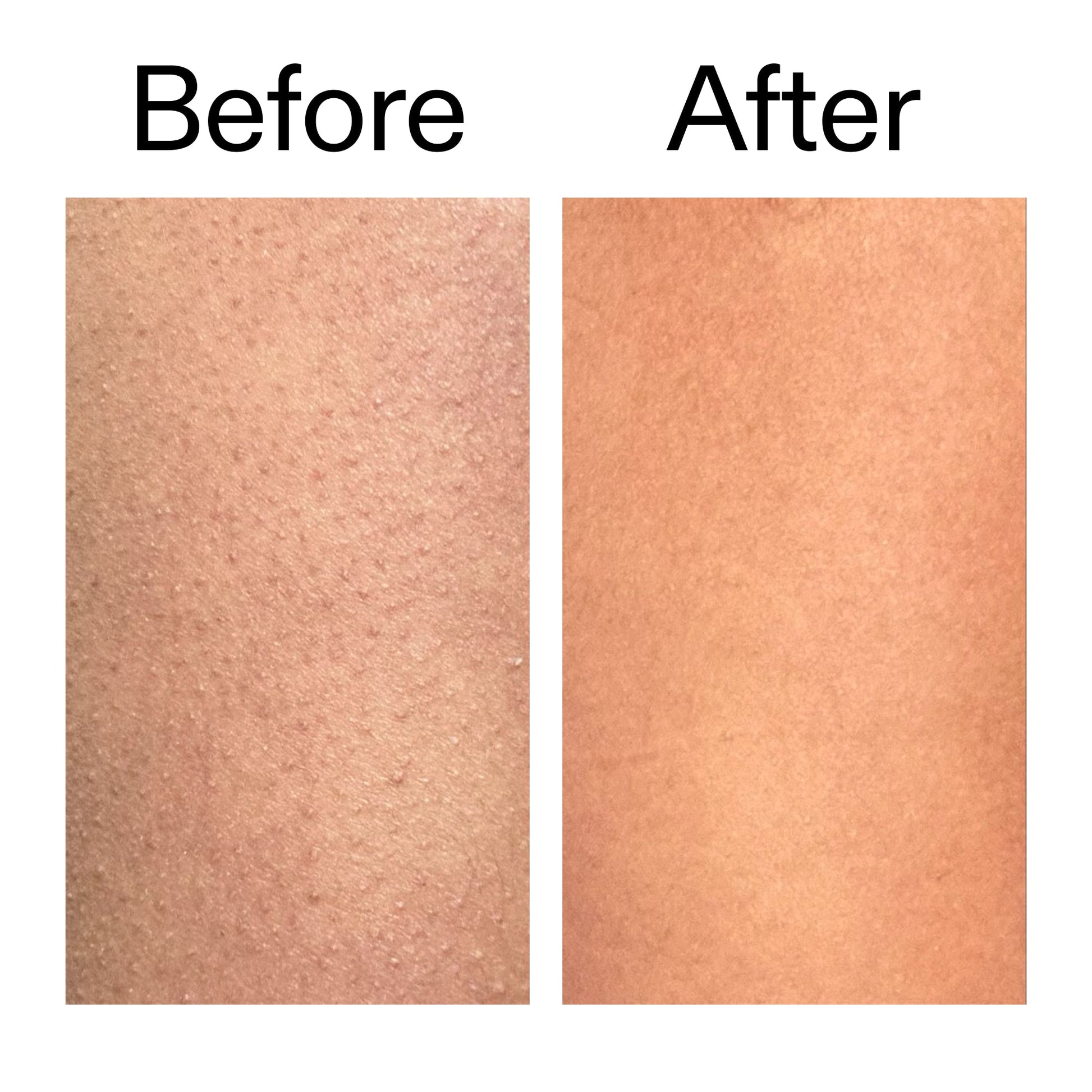 glycolic-acid-exfoliating-body-stick-duo-k6 Glycolic_Body_Stick_B_A_2000x2000_6e6e6b4d-5bd7-43c0-aeed-4d66788e8995.jpg