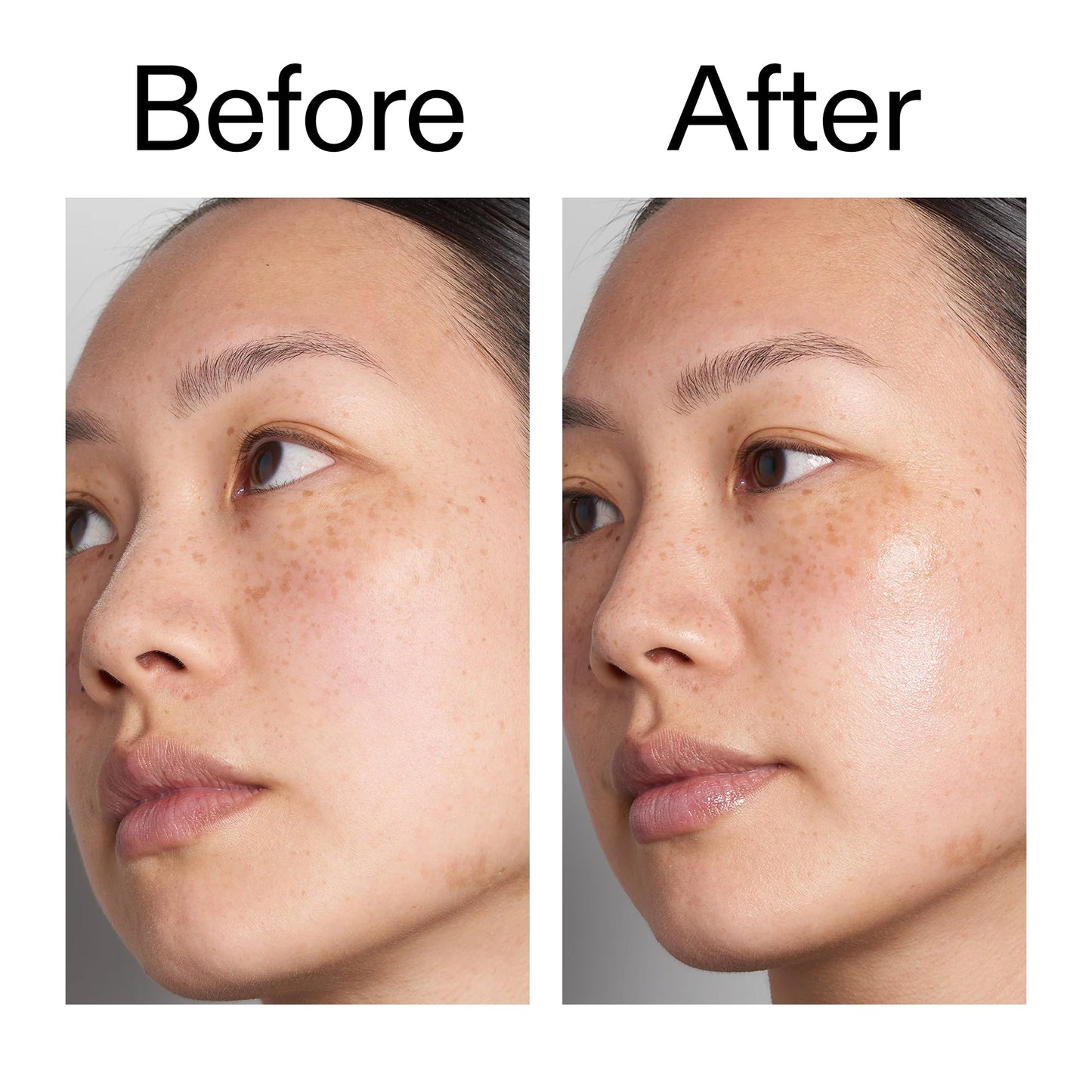 hyaluronic-acid-serum-60ml-y9 Hyaluronic_Acid_Before_After_2000x2000_d7983956-8aa2-4ea3-8255-c63e8d4f892e.jpg