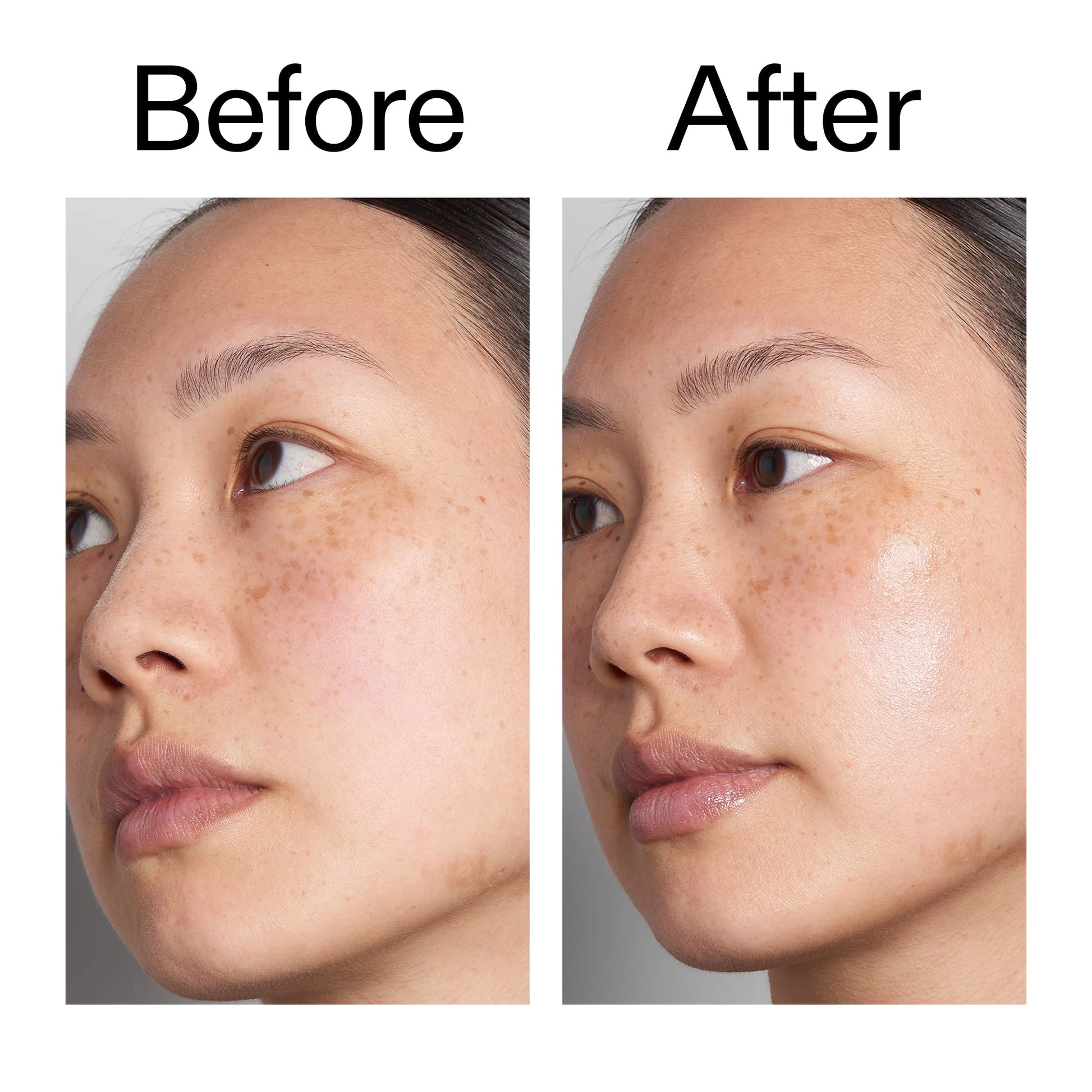 hyaluronic-acid-serum-30ml-s4 Hyaluronic_Acid_Before_After_2000x2000_d7983956-8aa2-4ea3-8255-c63e8d4f892e.jpg
