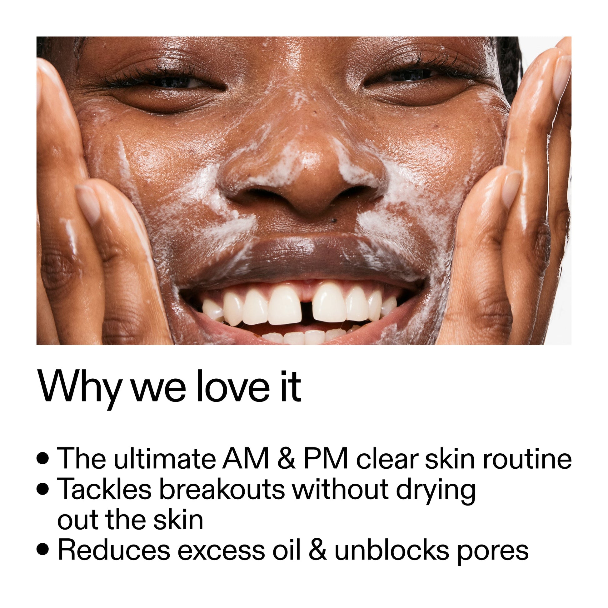 intro-routine-for-acne-d7 Intro_Routine_for_Acne_Why_we_love_it_2000x2000_42499e10-4629-4a0e-a627-7e215f4da6bc.jpg
