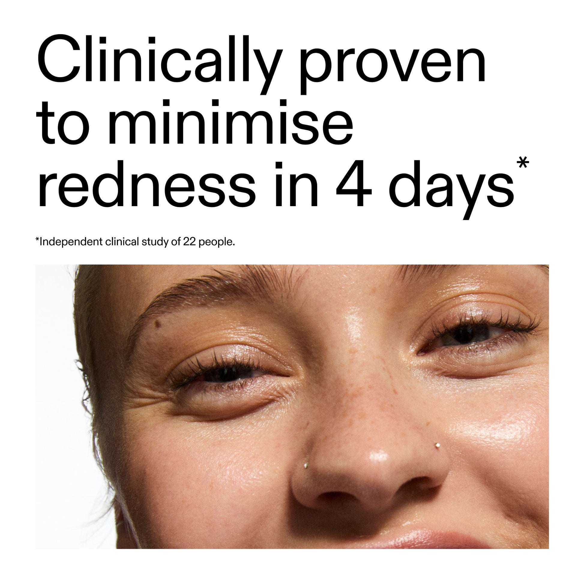 10-azelaic-acid-serum-for-redness-relief-s9 Oat_Cleansing_Balm_Claim_2000x2000_52a841dc-353c-4f2c-8646-3aadb604507d.jpg