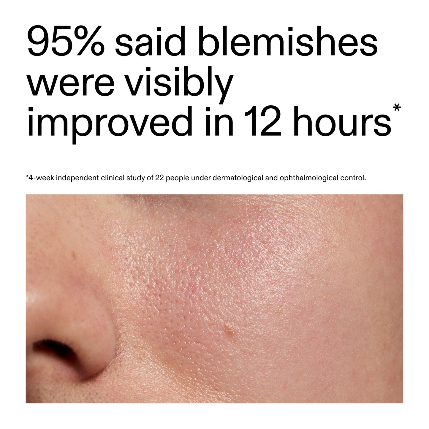 succinic-acid-acne-treatment-y3 Oat_Cleansing_Balm_Claim_2000x2000_ac6ce553-25db-41b2-a981-faae1ac4b8c0.jpg