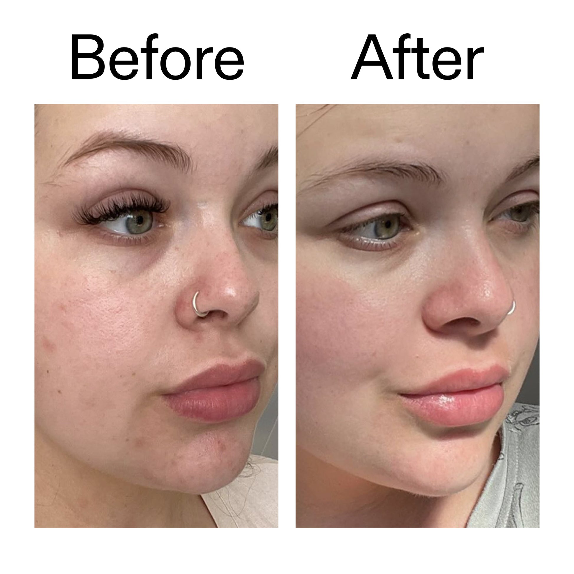 supersize-omega-water-cream-duo-r4 Omega50_Before_After_2000x2000_46483ed8-3f9d-487f-9a0c-9df79830bd65.jpg