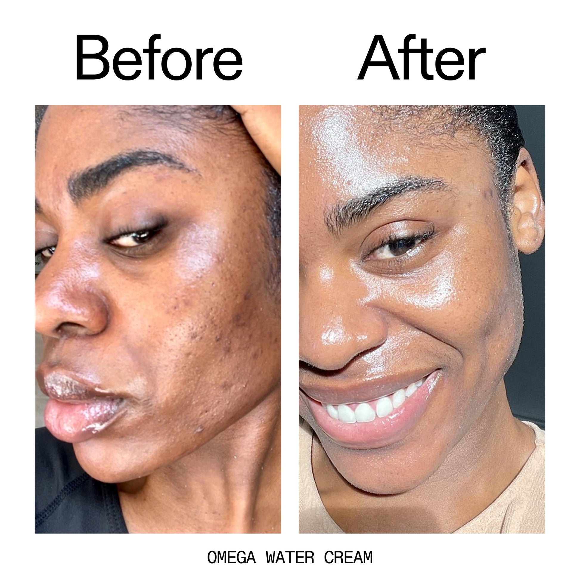 hydrating-cleanser-and-moisturizer-duo-e8 Omega_Water_Cream_Before_After_2000x2000_8e88278b-8c8d-48dc-ac77-4e98ebbd1b77.jpg