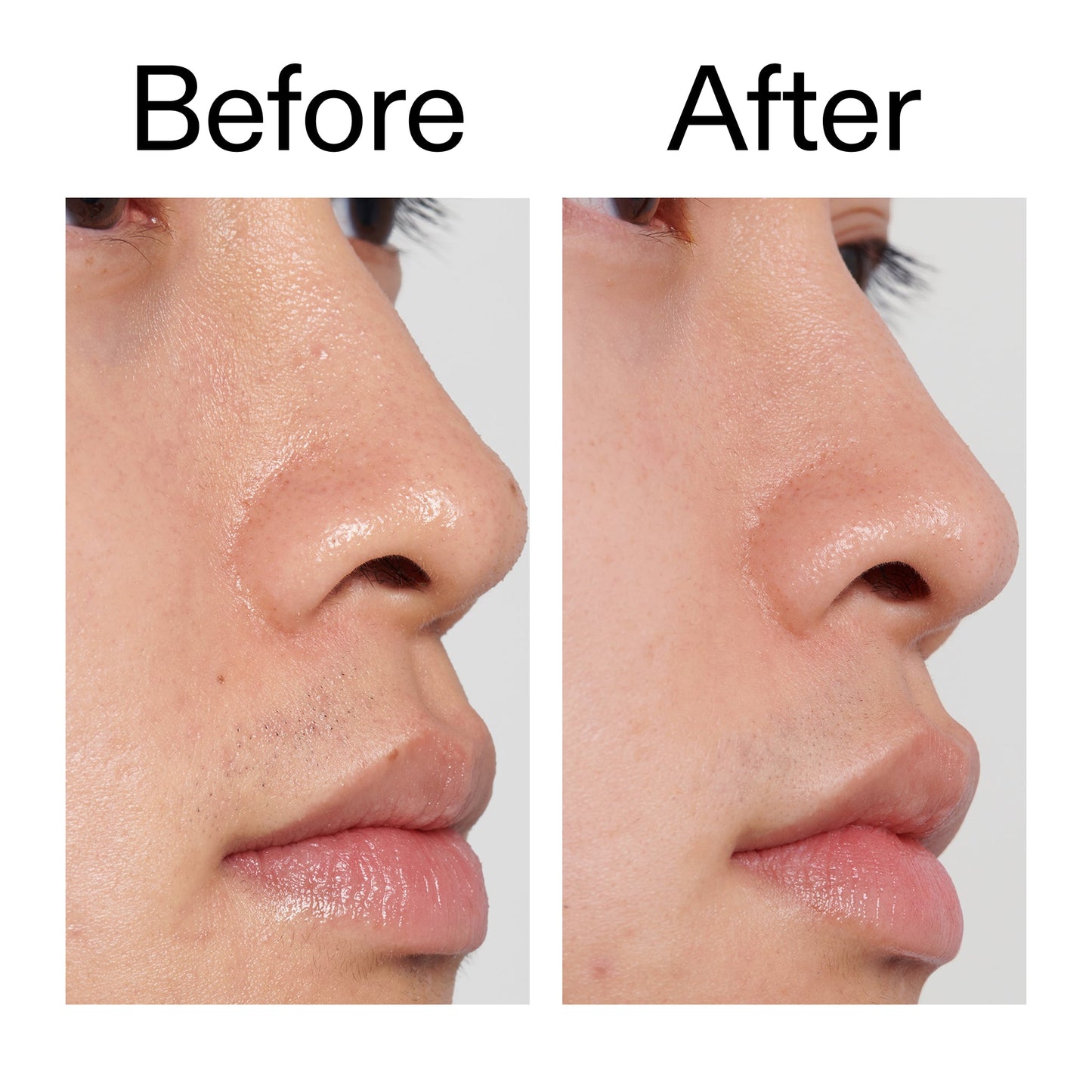 pha-toner-n0 PHA_Toner_Before_After_2000x2000_e3c10172-0150-4342-8b95-57417eaff50d.jpg