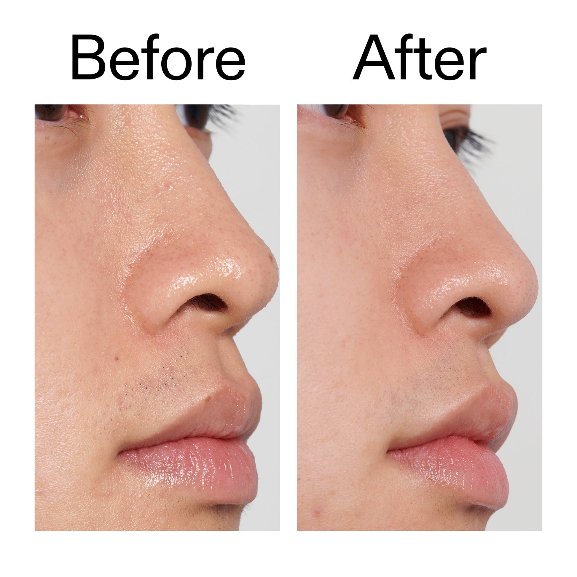 pha-toner-n0 PHA_Toner_Before_After_2000x2000_e3c10172-0150-4342-8b95-57417eaff50d.jpg