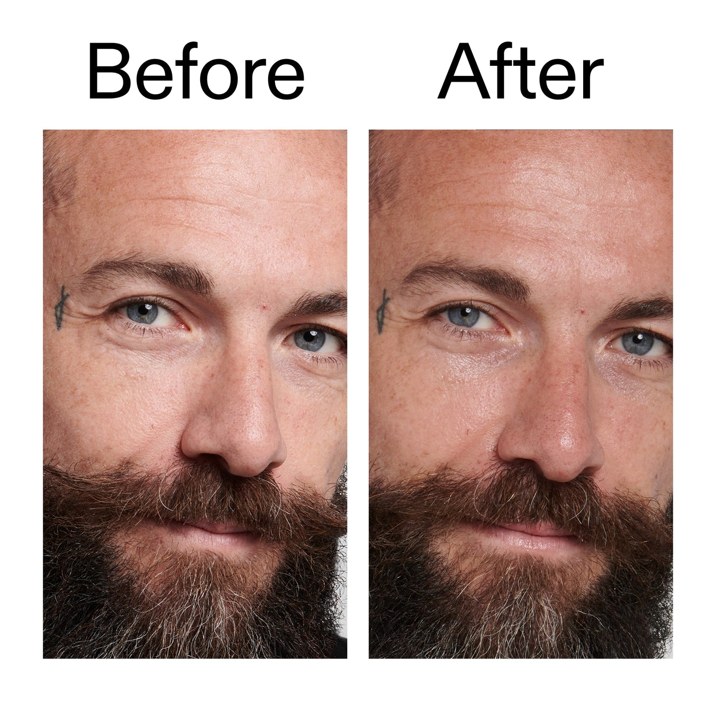 peptide-moisturizer-f7 Peptide_Moisturizer_Before_After_2000x2000_84623fe4-7b72-4f89-8e87-5edb6c752ac5.jpg