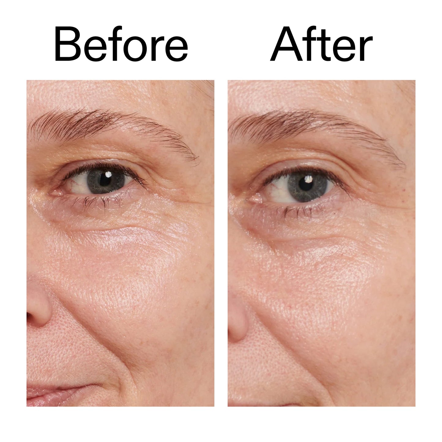 retinol-eye-cream-s7 Retinol_Eye_Cream_Before_After_2000x2000_ac03a80c-109e-4572-a95a-91dc109b4d27.jpg