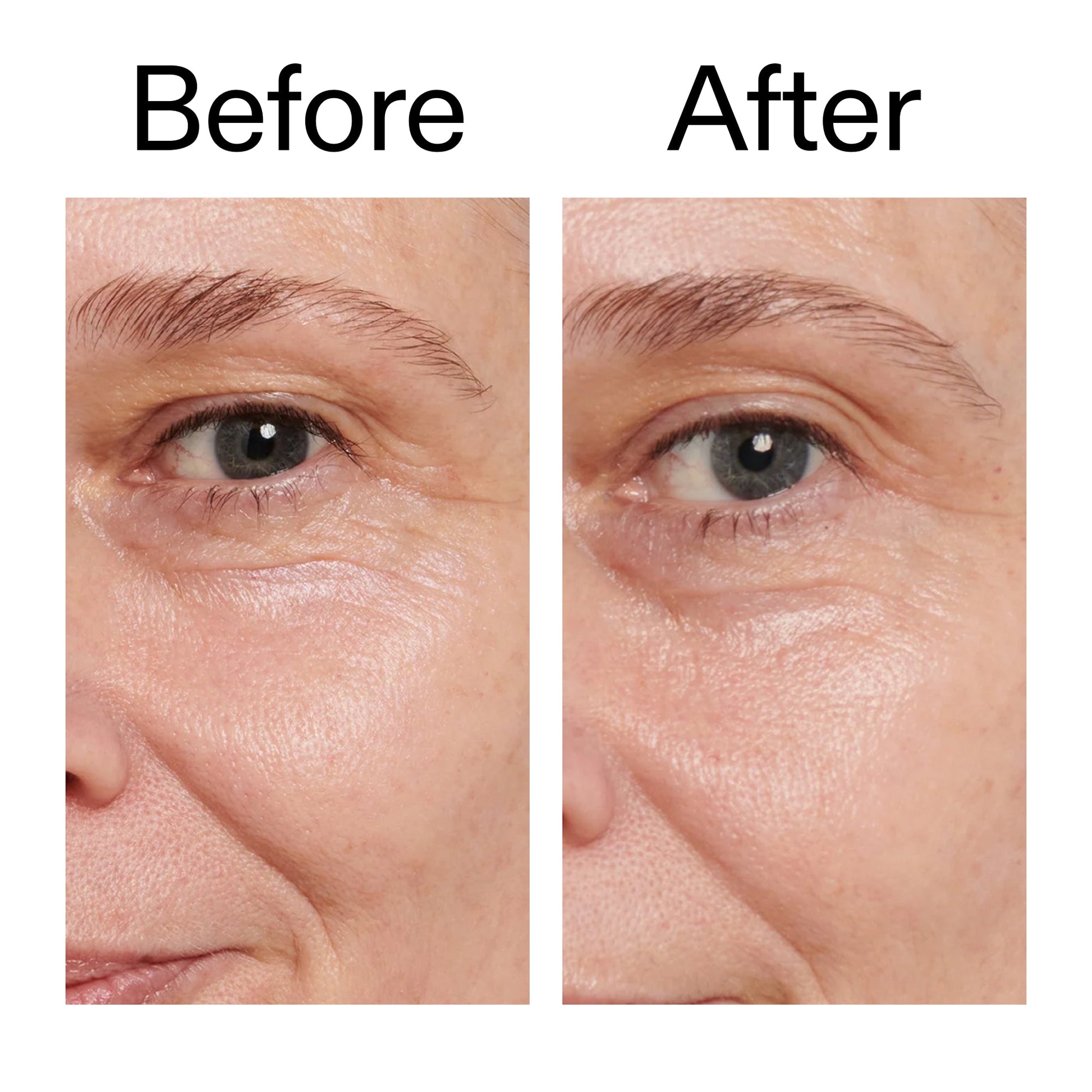 retinol-eye-cream-s7 Retinol_Eye_Cream_Before_After_2000x2000_ac03a80c-109e-4572-a95a-91dc109b4d27.jpg