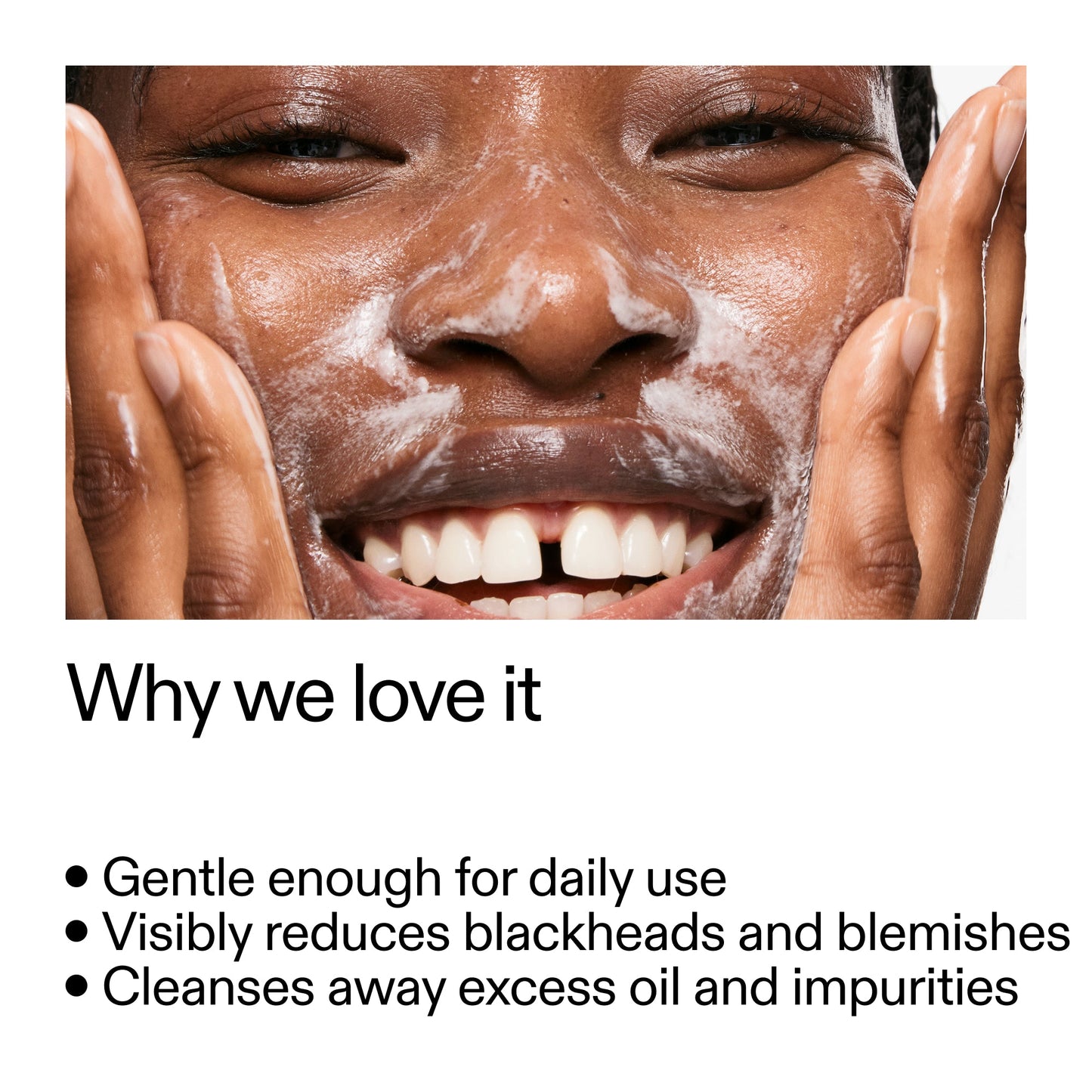 salicylic-acid-cleanser-150ml-w0 Salicylic_Acid_Cleanser_-_300mlWhy_we_love_it_2000x2000_87dc92a9-2559-4309-98cd-4e570f1be735.jpg
