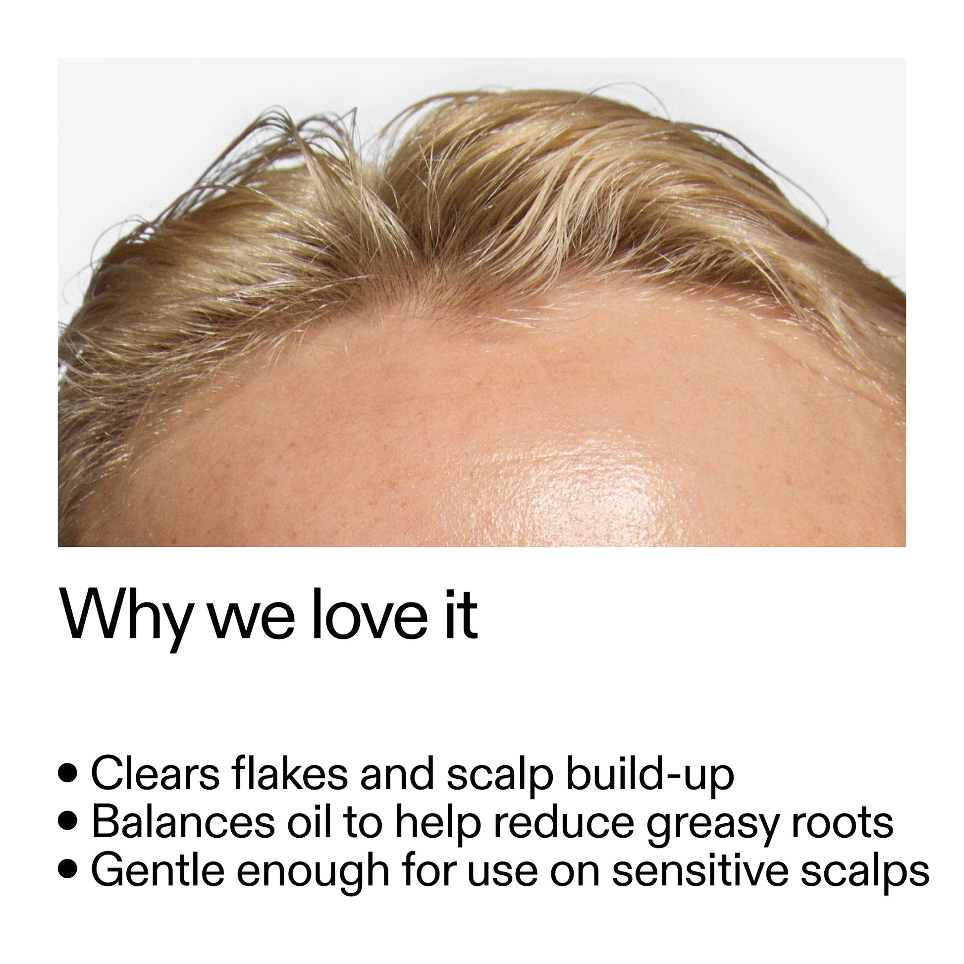 salicylic-acid-exfoliating-scalp-treatment-d7 Salicylic_Acid_Exfoliating_Scalp_Treatment_Why_we_love_it_2000x2000_44b6bd6d-9ec4-4b23-9dc4-bc3fd6f28e14.jpg