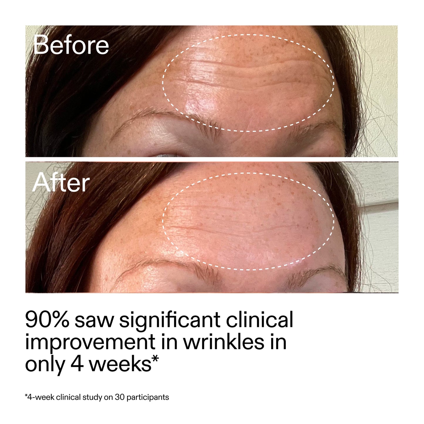 starter-retinol-serum-duo-r9 StarterRetinol_BeforeAfter_Claim1_2000x2000_03b4d6e5-a357-43b9-a855-aba5e35c57f3.jpg