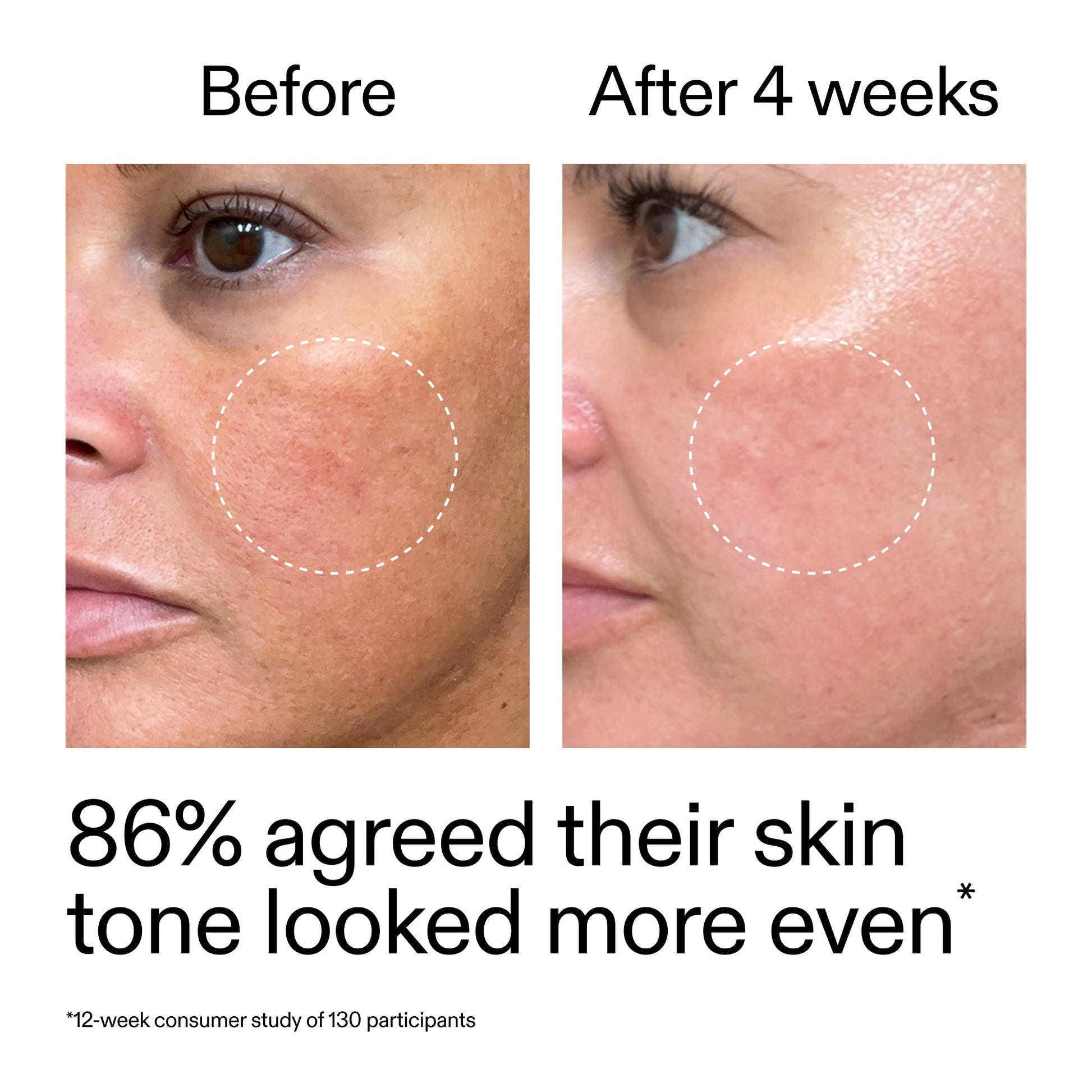 starter-retinol-serum-k5 StarterRetinol_BeforeAfter_Claim2_2000x2000_f5c9ecc0-8d76-429d-bef5-c3a61bcf5c09.jpg