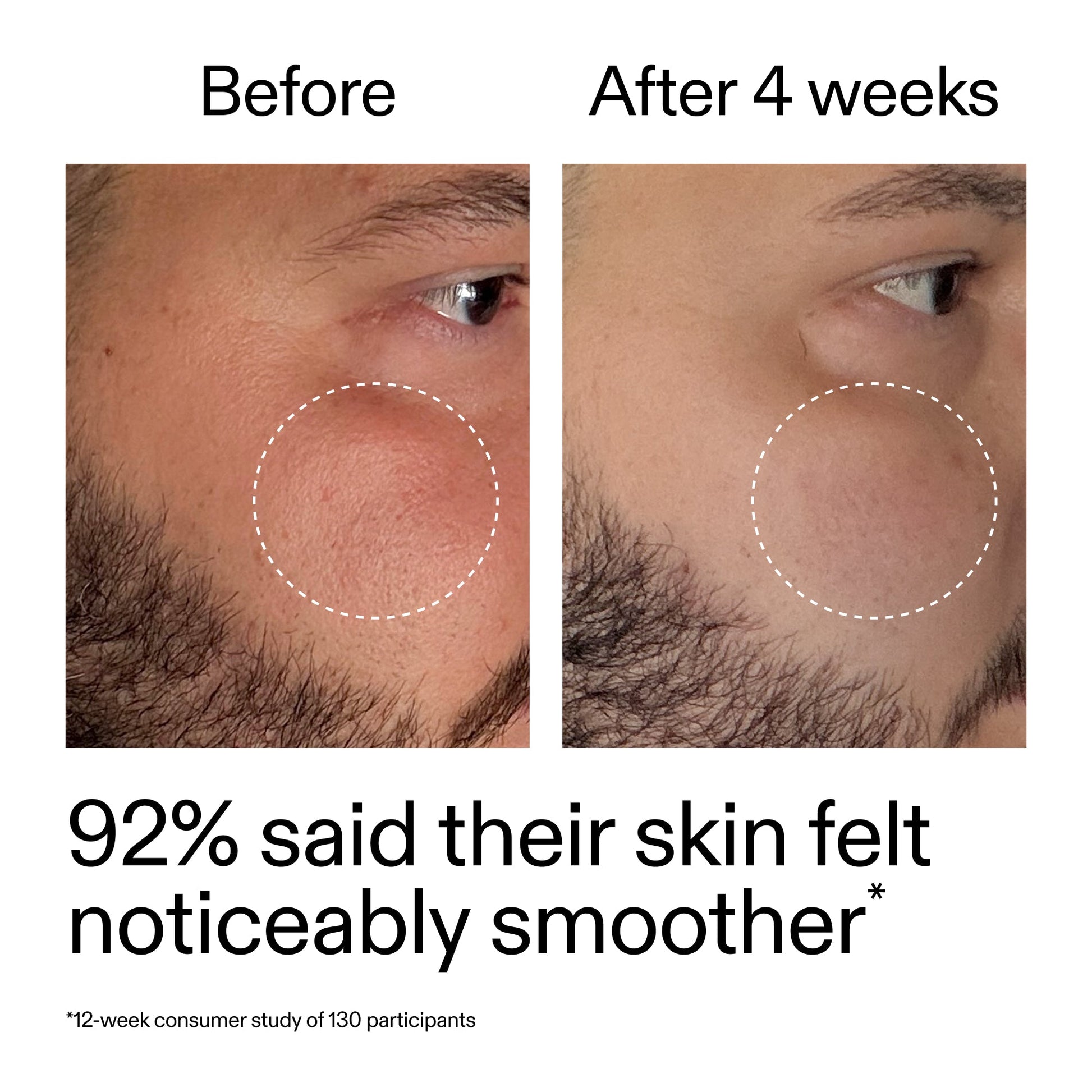 starter-retinol-serum-duo-r9 StarterRetinol_BeforeAfter_Claim3_2000x2000_458243a8-bbb0-4e5d-a274-29c7766d339b.jpg