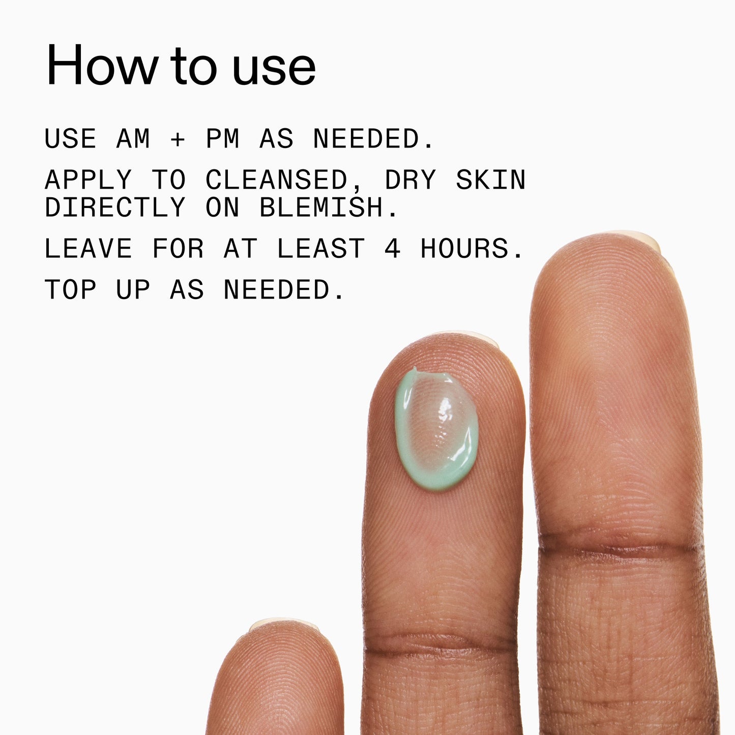 succinic-acid-acne-treatment-y3 Succinic_Acid_Treatment_How_to_Use_2000x2000_d57137d5-d7f1-427c-9a46-5fc00c19c542.jpg