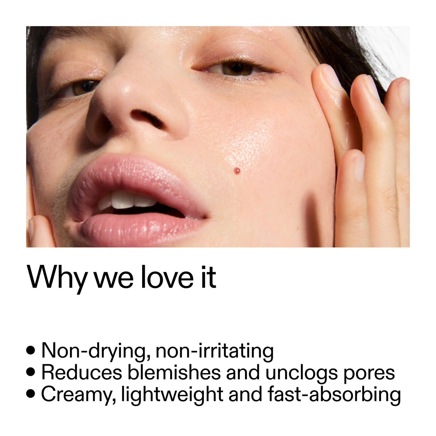 succinic-acid-acne-treatment-y3 Succinic_Acid_Treatment_Why_we_love_it_2000x2000_e90dd42a-cfe9-48b5-a2c7-d5eda787a6a8.jpg