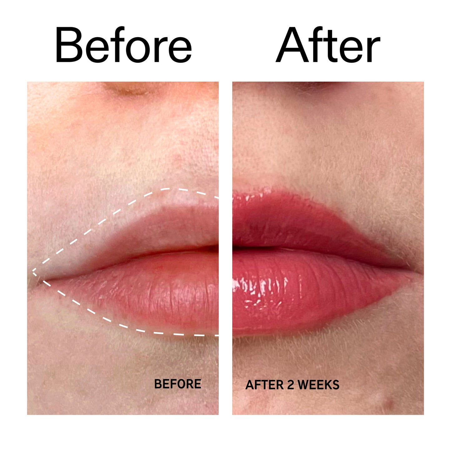 tripeptide-plumping-berry-lip-balm-x7 Tripeptide_Plumping_Lip_Balm_-_Berry_Before_After_2000x2000_9474bbd8-43ca-4b0e-b0e7-dfab70b91927.jpg