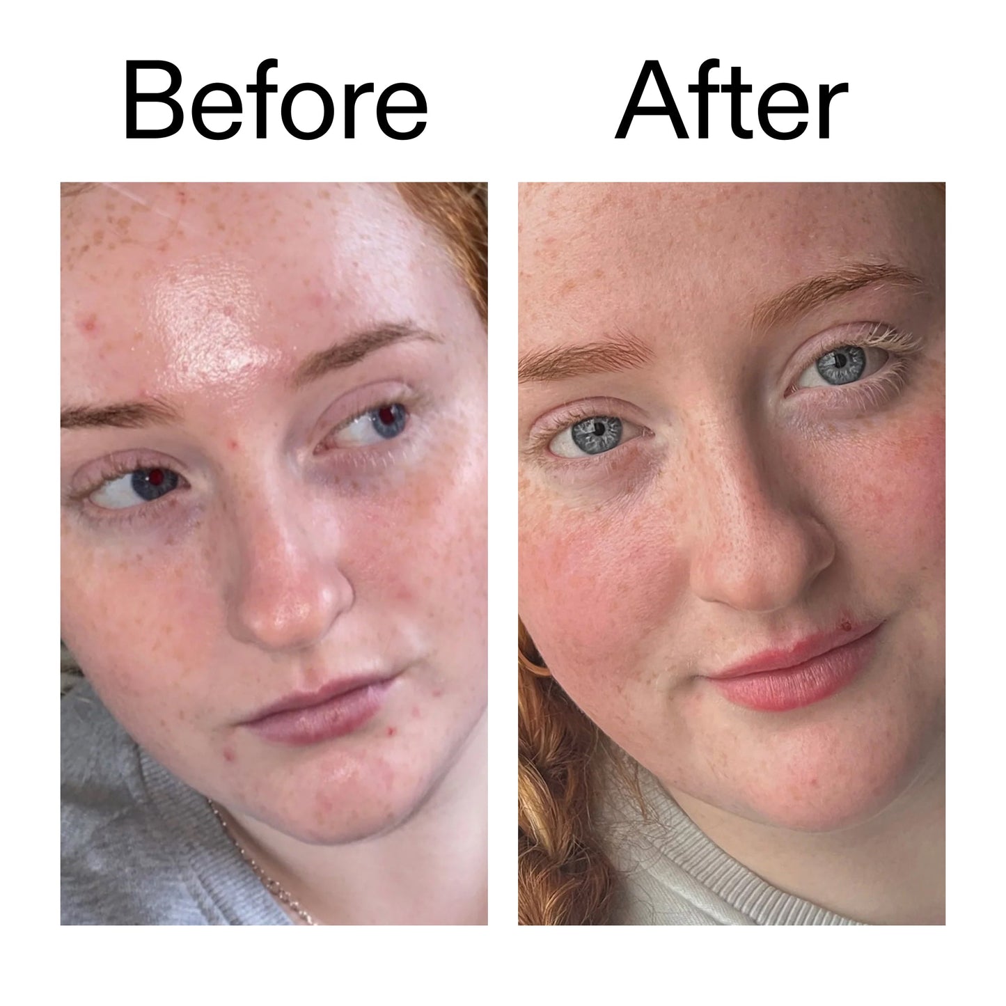 vitamin-b-c-and-e-moisturizer-g2 Vitamin_B_C_and_E_Moisturizer_Before_After_2000x2000_b0781a76-5ad2-4be9-95b8-ef92b356833c.jpg